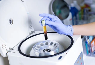 Ускоренное заживление (PRP-терапия)