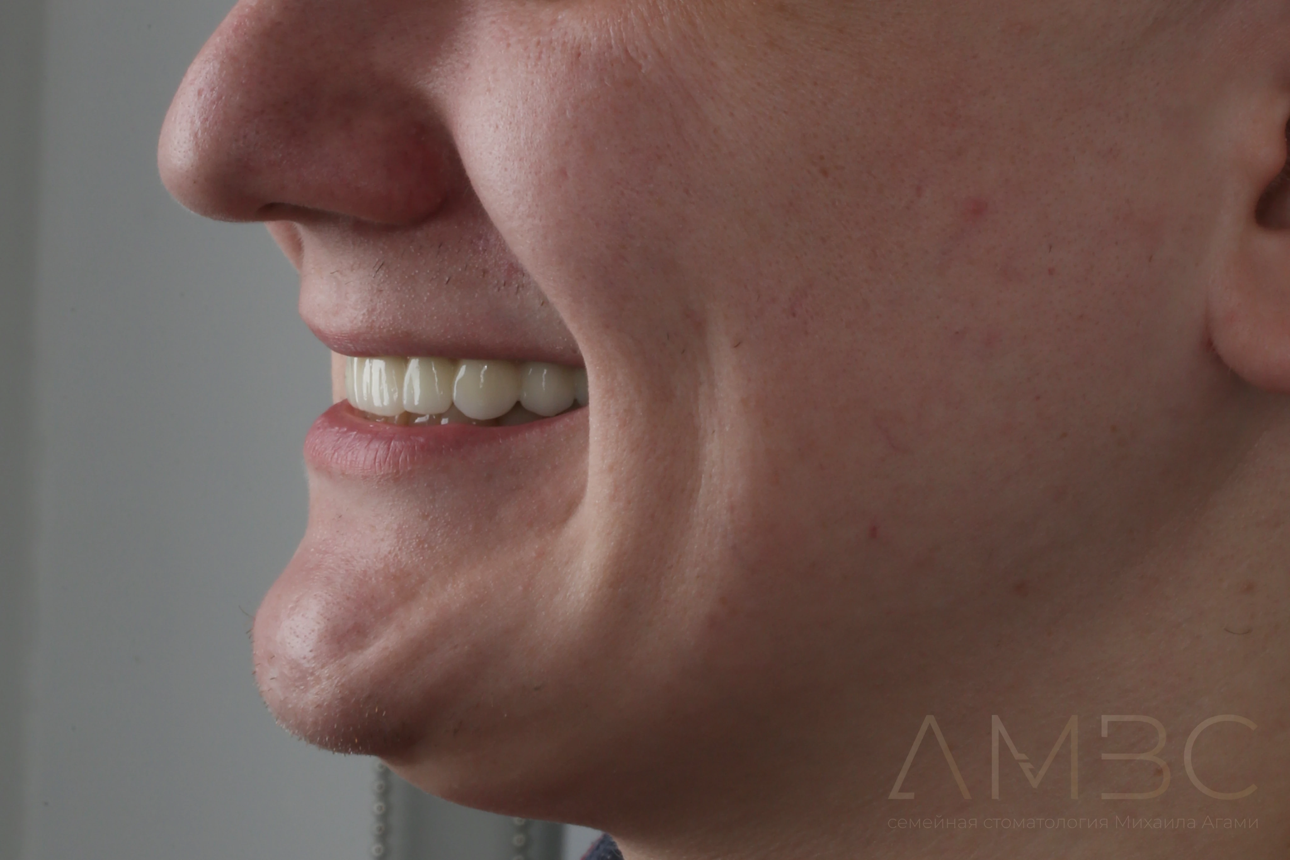 Имплантация и протезирование Имплантация и протезирование